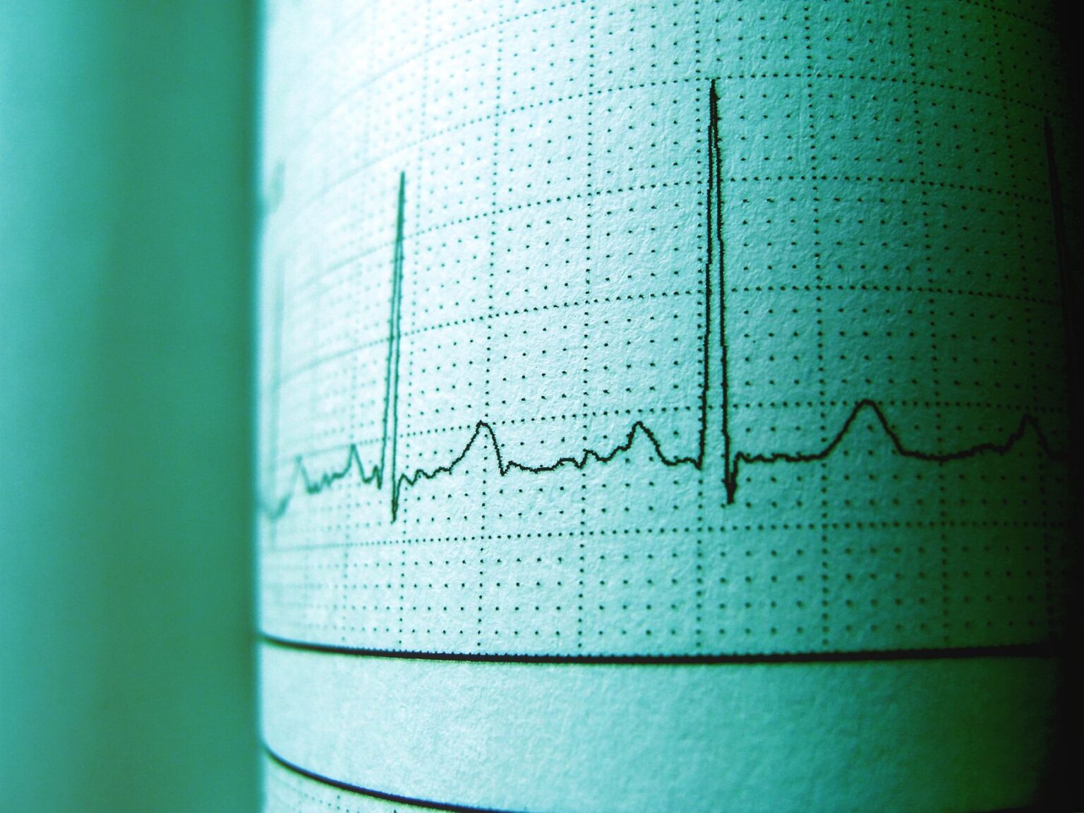 Wykres EKG w kolorze zielonym rejestrujący rytm i tętno na papierze milimetrowym